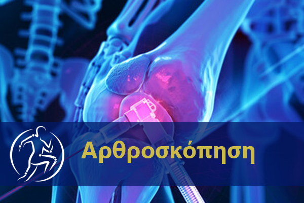 Αρθροσκόπηση Dr Κορμάς