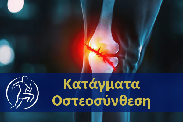 Οστεοσύνθεση Dr Κορμάς