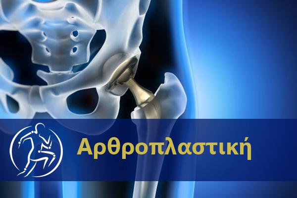 Αρθροπλαστικη Dr Κορμάς
